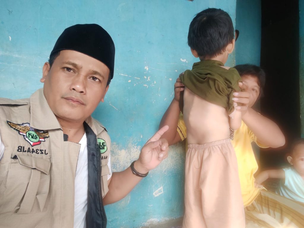 Anggota DPRD Mateng Sambangi Rumah Bocah Penderita Bengkok Tulang Belakang